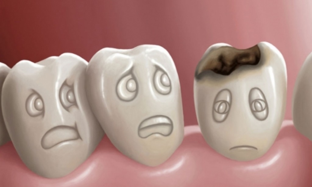 Kako su naši preci liječili karijes prije 14 hiljada godina?