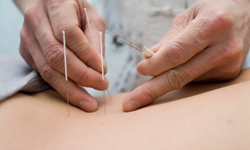 Komplementarna i alternativna medicina