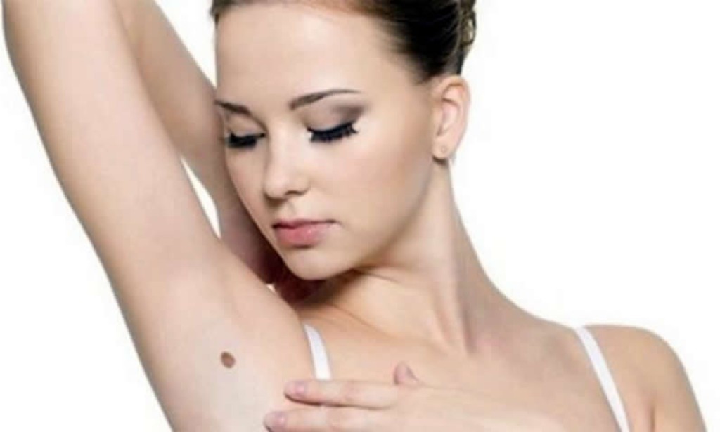 Prirodni lijek za viseće bradavice