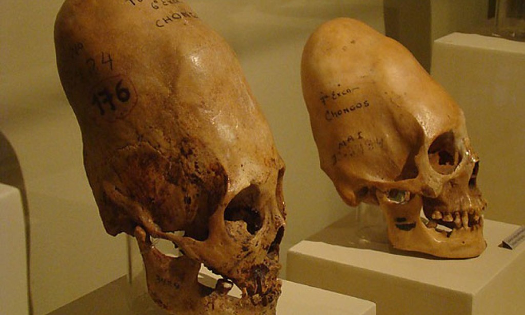 Peru: Pronađene izdužene lobanje vanzemaljaca