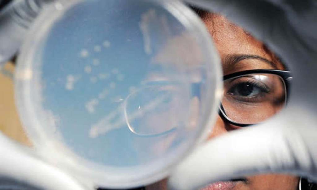 Fizički uticaj na razvoj mikroorganizama