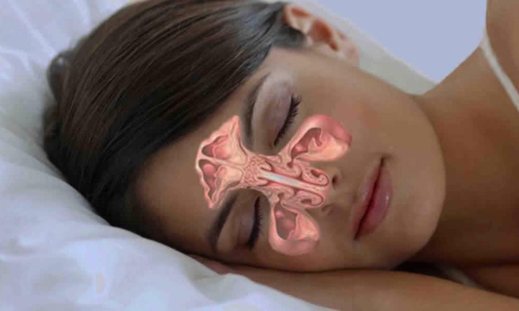 Prirodni lijek za probleme sa sinusima