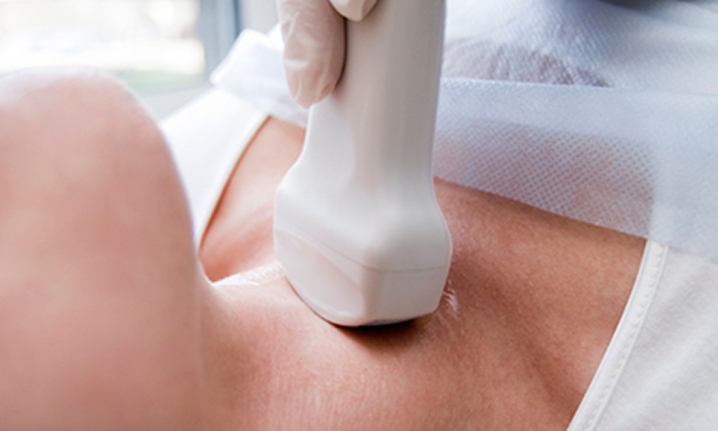 Hipotireoza: Liječenje prirodnim putem