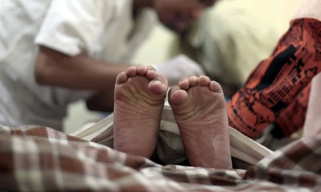 Šta je sunećenje (obrezivanje) i za šta je sve dobro?