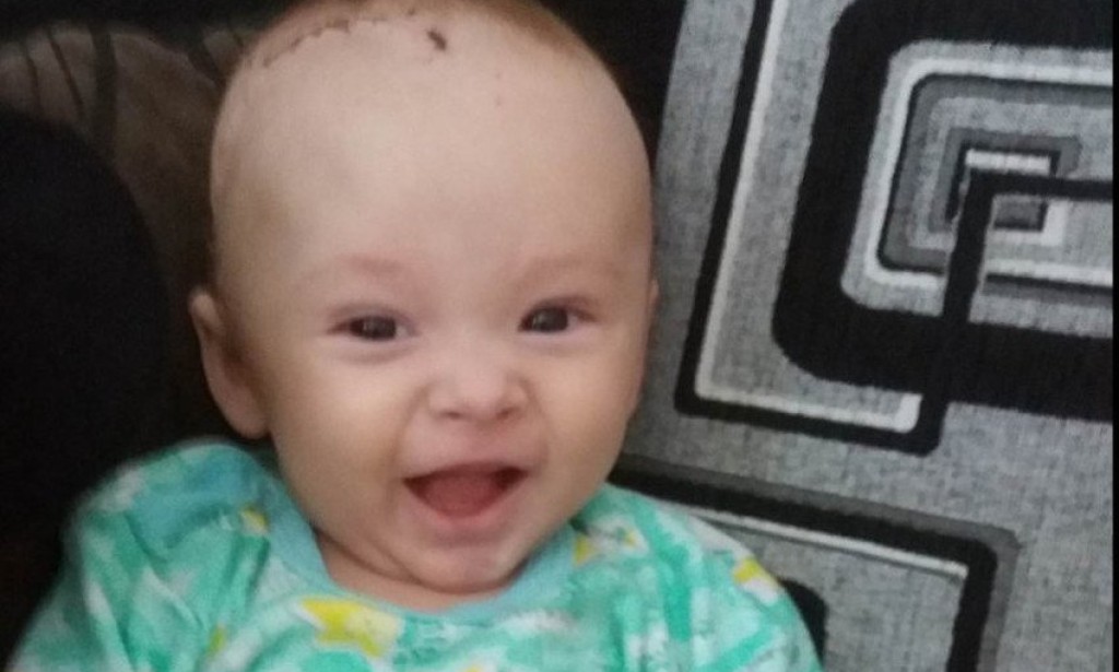 Šestomjesečni Arslan Kulačić hitno treba pomoć za liječenje u Turskoj