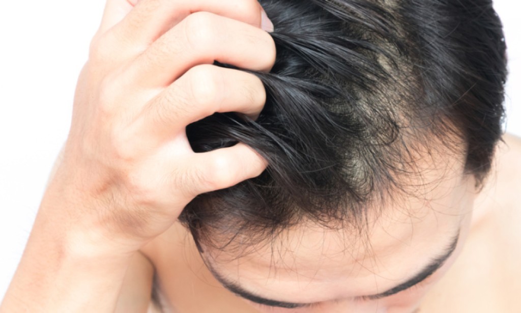 Soda bikarbona uklanja perut: Evo kako! (RECEPT)