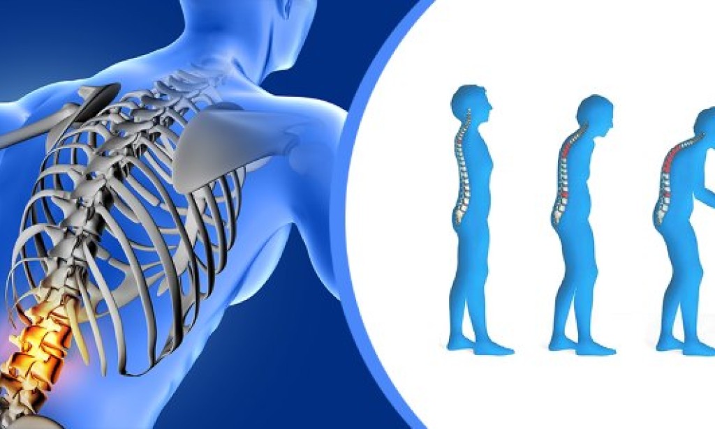 Osteoporoza (poroznost kostiju)