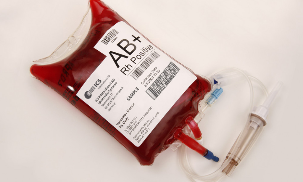 Misteriozna Krvna Grupa AB+: Univerzalni Primalac i Njena Jedinstvena Osobnost