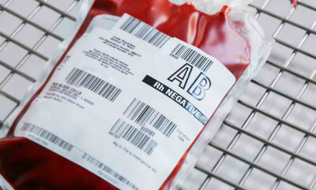 AB- Krvna Grupa: Najrjeđi Primalac i Njena Racionalna, Intuitivna Priroda