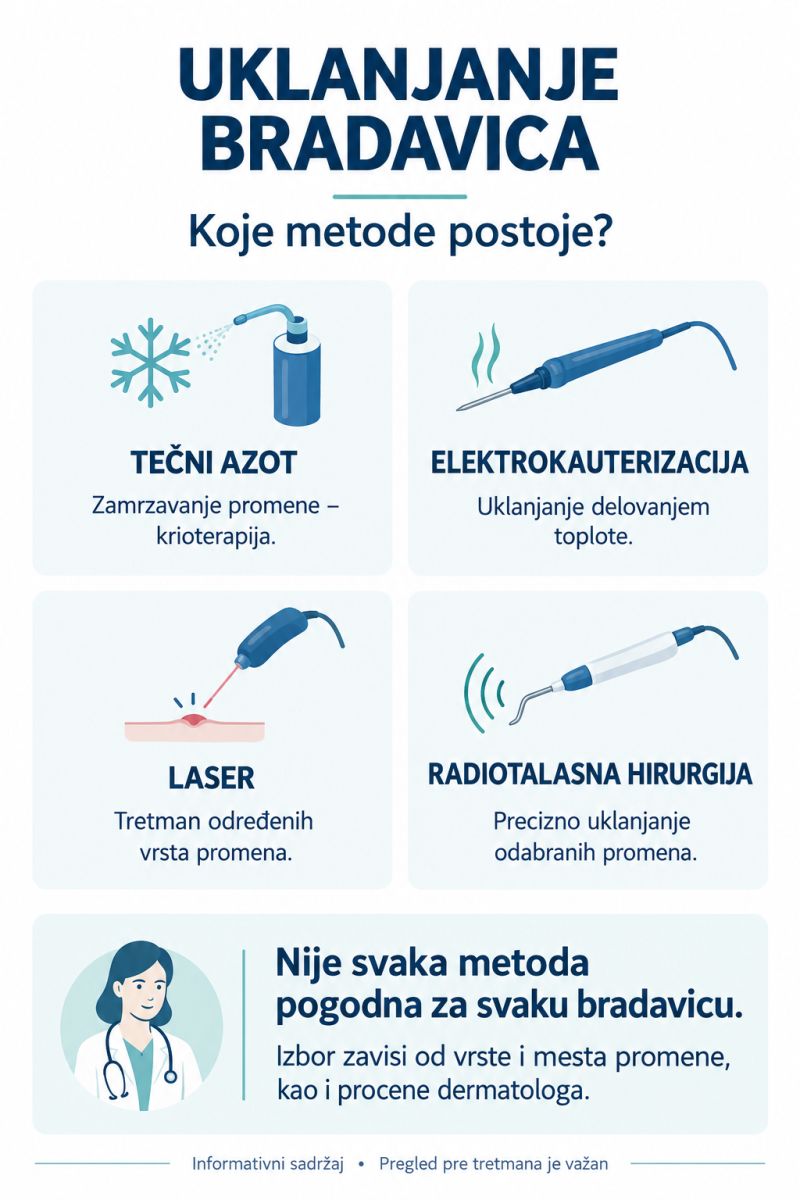 Uklanjanje bradavica, metode - infografika